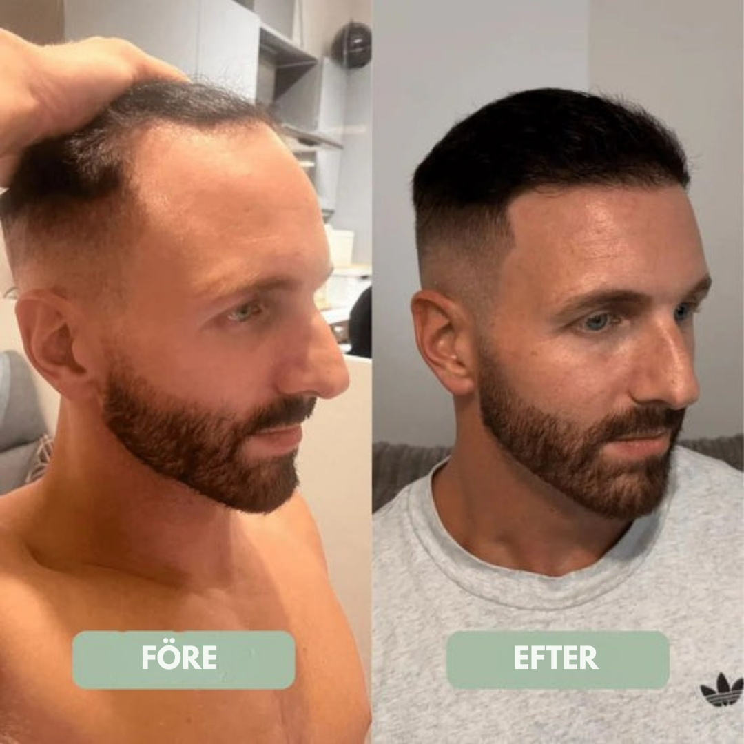 HårBalans™ | Hårväxtserum Roll-On