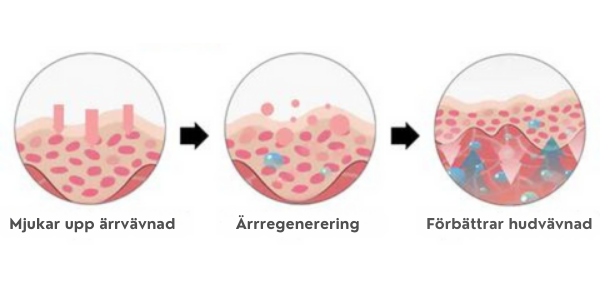 Avancerad ärrspray för alla typer av ärr ⚡️