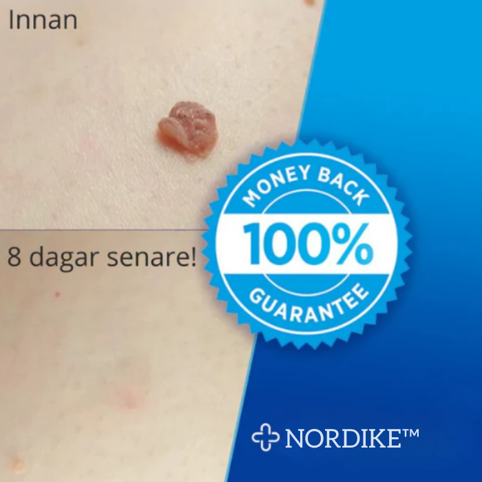 NORDIKE™ - Premiumset mot hudflikar – Synliga resultat utan smärta
