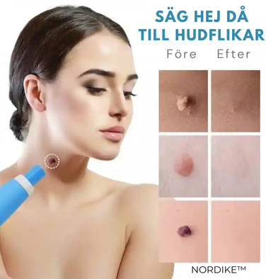 NORDIKE™ - Premiumset mot hudflikar – Synliga resultat utan smärta
