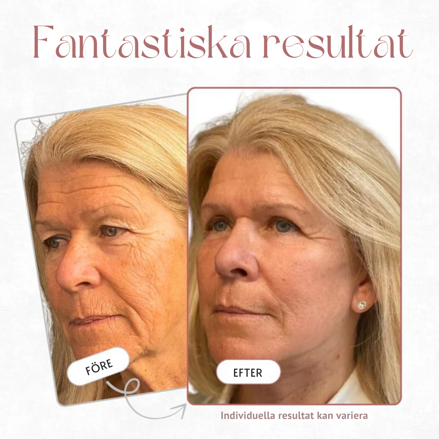 Lysterlyft – Multiverkande Kalciumbalsam