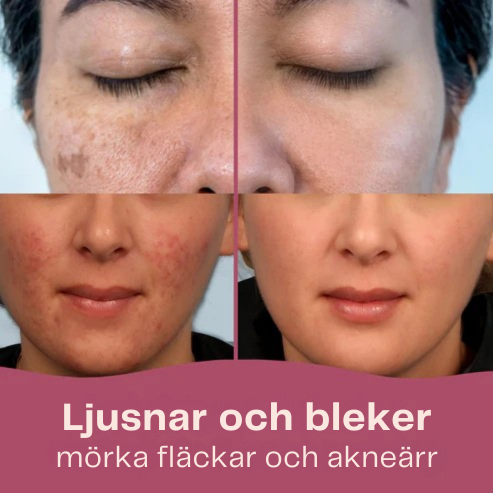 Soloria - Ljusande pads med gurkmeja och kojinsyra