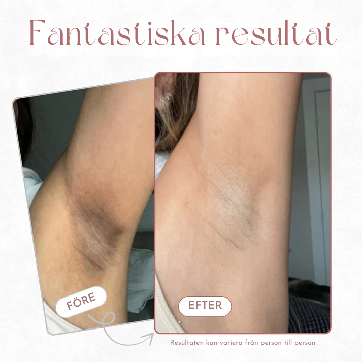 KlarHud | Kojic +Gurkmeja Kroppspeelingspray