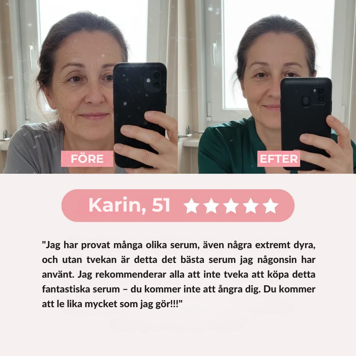 Elyna - PDRN Rosa Kollagen Exosom Shot Serum