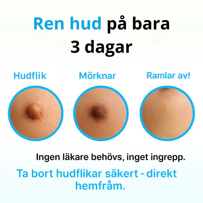NORDIKE™ - Premiumset mot hudflikar – Synliga resultat utan smärta