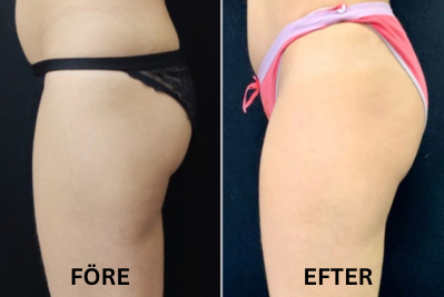 FORMÉA | Där skönhet tar form