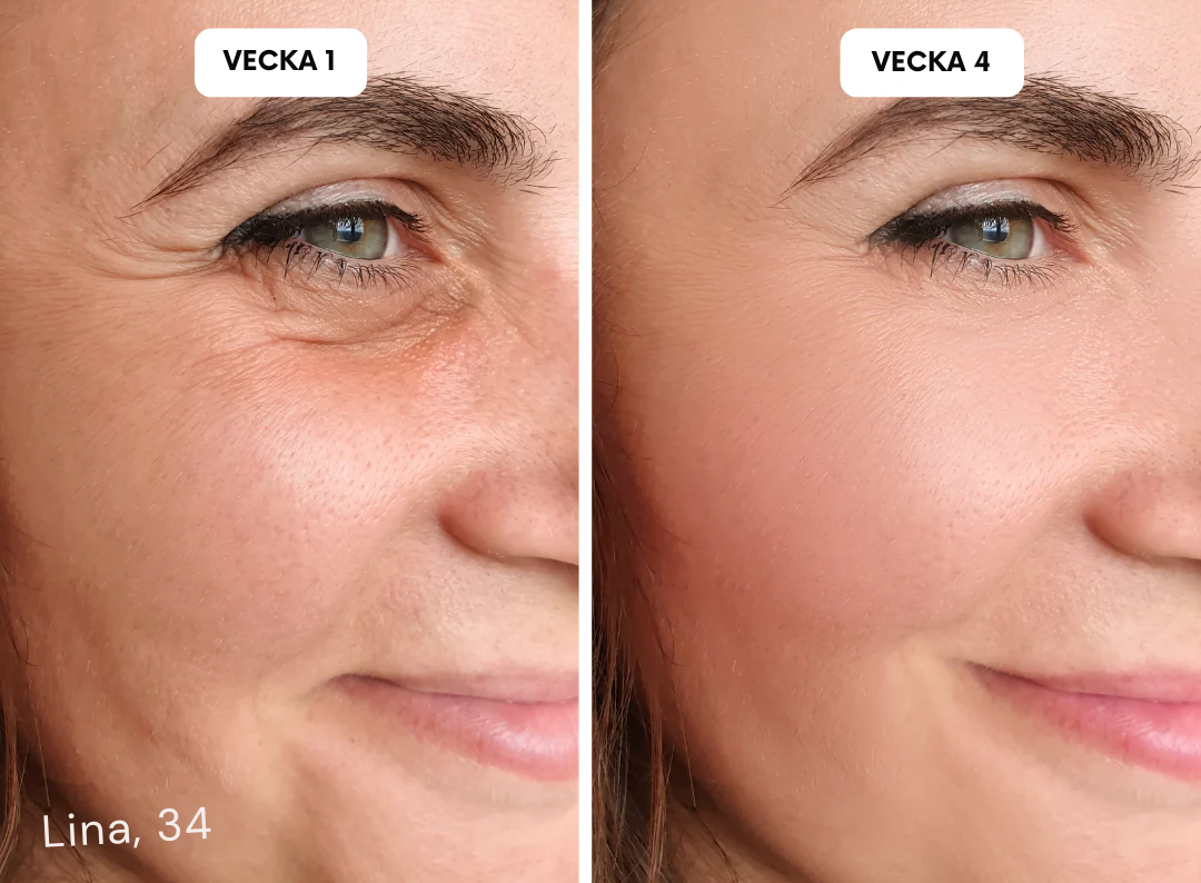 HudLäk | Ärrlösningar