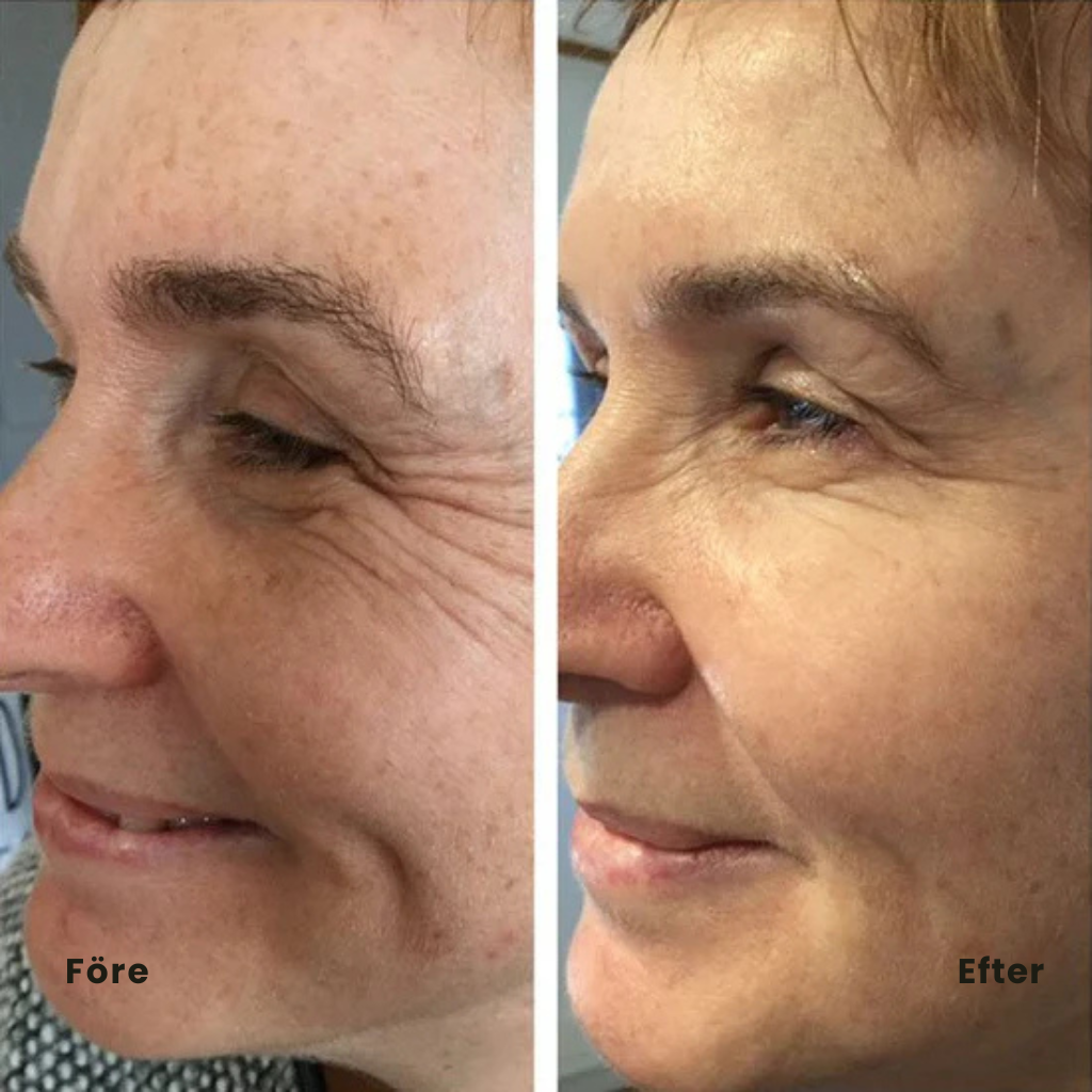 PeptidLift™ | Inomega avancerat PDRN Peptide-8-serum