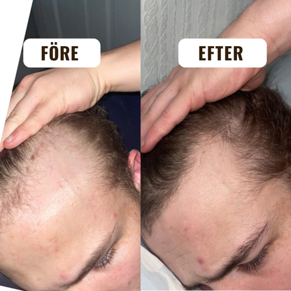 HårVital™ | Närande hårolja Som hjälper till att stimulera ny hårväxt och stärka hårsäckarna.