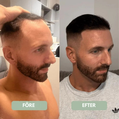 HårBalans™ | Hårväxtserum Roll-On