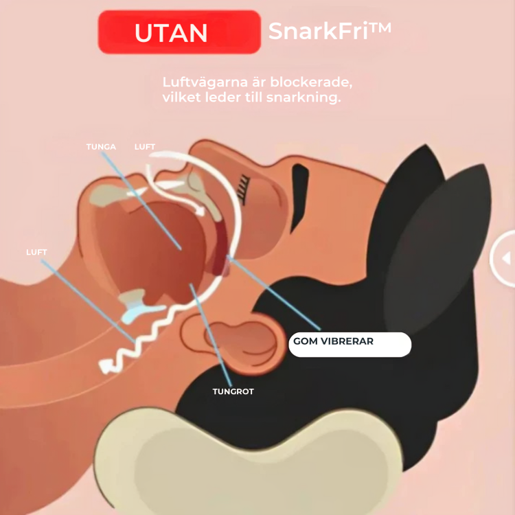 SnarkFri™ | ANTI-SNARK MUNSTYCKE