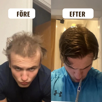 HårVital™ | Närande hårolja Som hjälper till att stimulera ny hårväxt och stärka hårsäckarna.