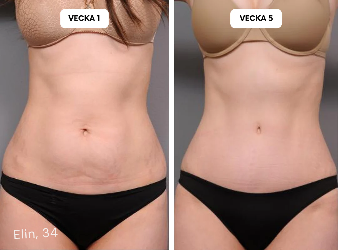 HudLäk | Ärrlösningar