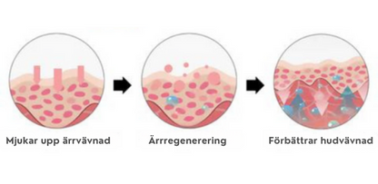 Avancerad ärrspray för alla typer av ärr ⚡️