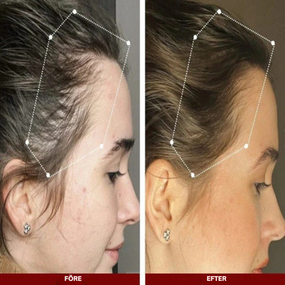 Hårkraft | Hårserum