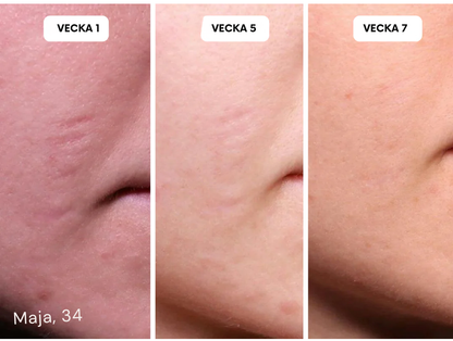 HudLäk | Ärrlösningar