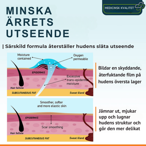 Avancerad ärrspray för alla typer av ärr ⚡️