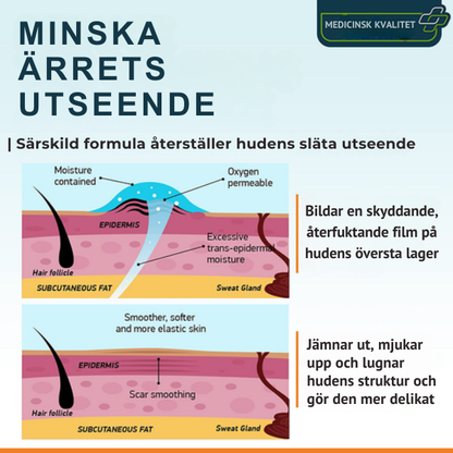 Avancerad ärrspray för alla typer av ärr ⚡️