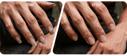 SmidigNagel™ | Säker Nagelvård