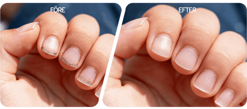 SmidigNagel™ | Säker Nagelvård