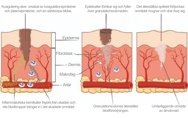 Avancerad ärrspray för alla typer av ärr ⚡️