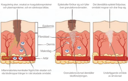 Avancerad ärrspray för alla typer av ärr ⚡️
