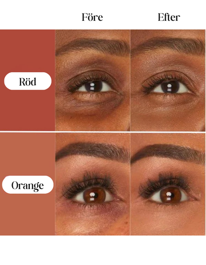 KlarUpp™ | Underögon Concealer