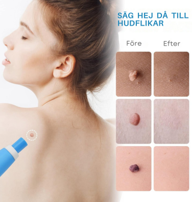NORDIKE™ - Premiumset mot hudflikar – Synliga resultat utan smärta