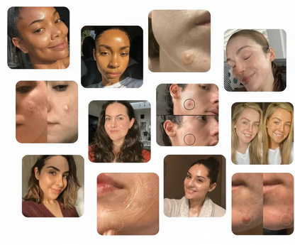 FinnRoll | Vävtejp för medicinskt bruk