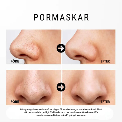 RisLyster | Peelinggel - 80ml