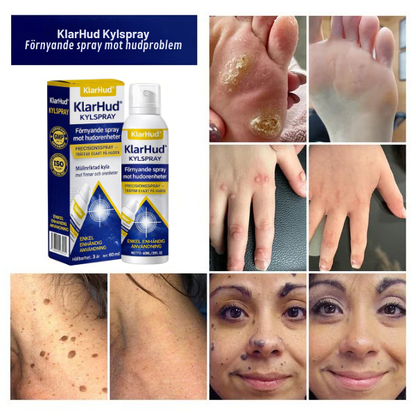 KlarHud® Kylspray | Förnyande spray mot hudorenheter