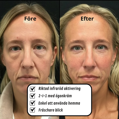 ÖgonGlans™ | Infraröd ögonvård för svullna ögon och mörka ringar