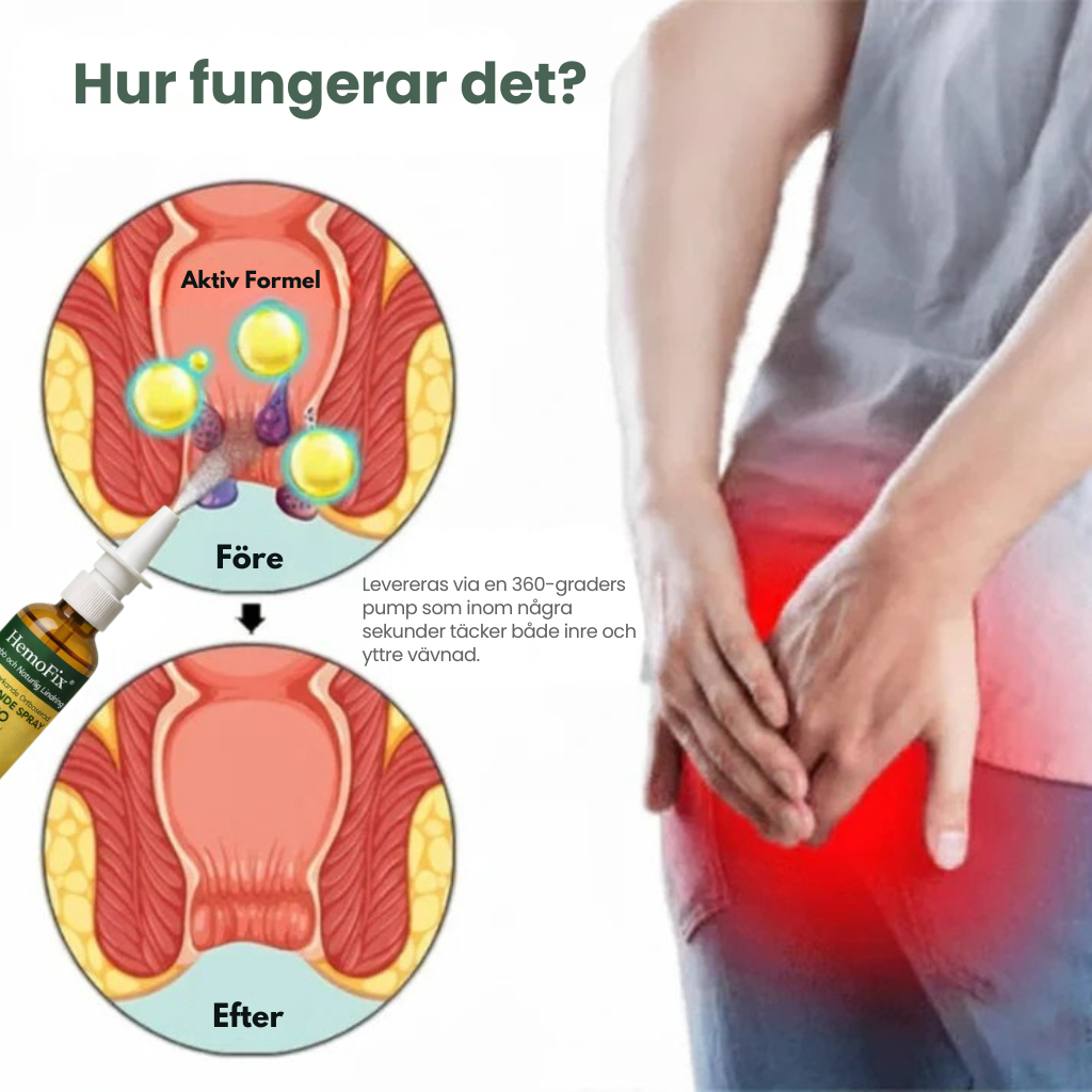 HemoFix | Snabbverkande örtbaserad spray för lindring av hemorrojder