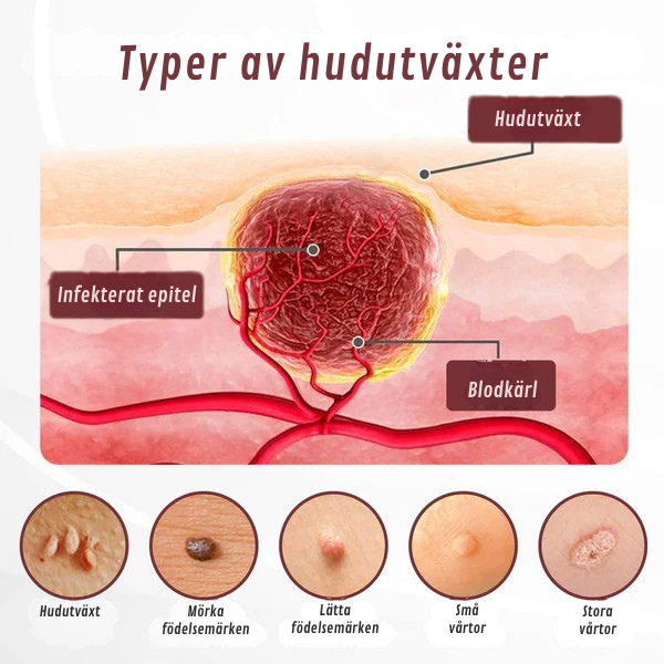 HudRen Dual™ | KeraErase Dual-Action Kräm för hudförnyelse