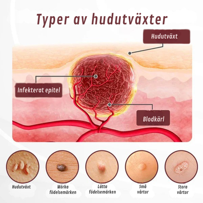 HudRen Dual™ | KeraErase Dual-Action Kräm för hudförnyelse