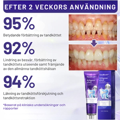 TandKraft™ | Tar bort plack och stärker tandköttet naturligt