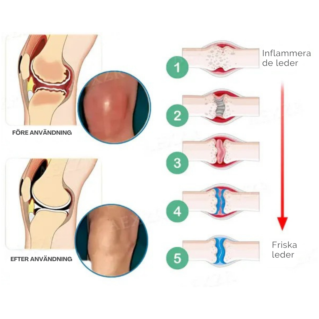 FriRörelse™ - Naturlig ledkräm med hyaluronsyra