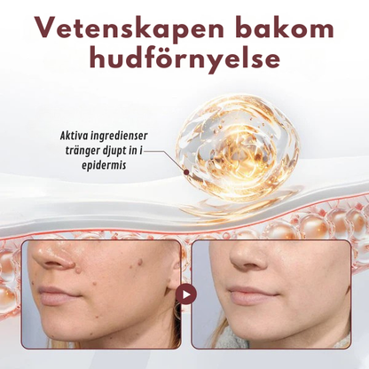 HudRen Dual™ | KeraErase Dual-Action Kräm för hudförnyelse