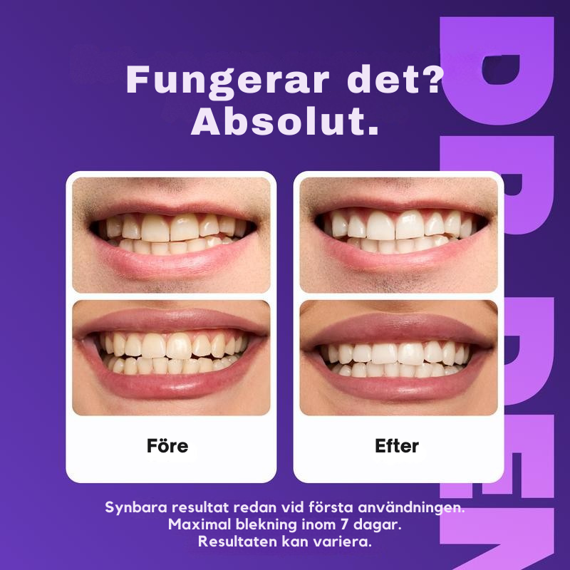 TandLjus™ | Professionella Tandblekningsremsor