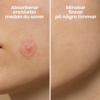 FinnRoll | Vävtejp för medicinskt bruk