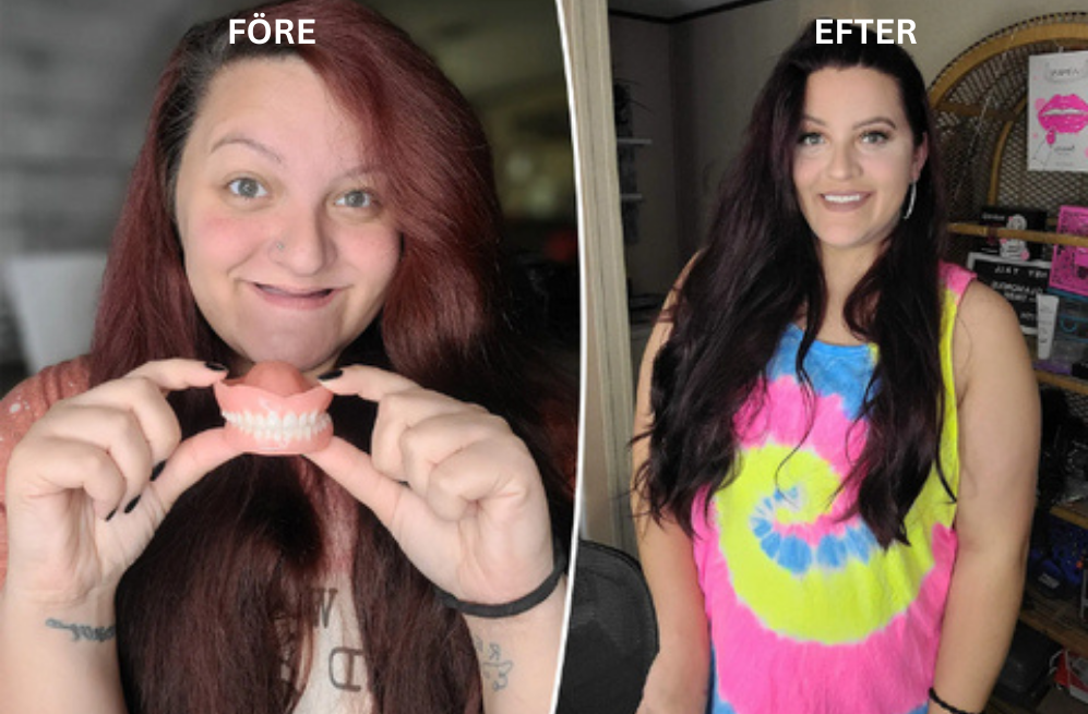 VardagsBalans proteslim | Säkert grepp utan daglig limning i upp till 3 dagar