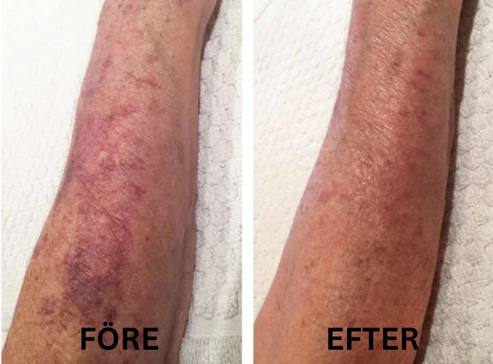 KlarHyll | Hudreparerande essence-kräm