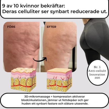 FormLyx™ | Kompression för mer kraft och uppstramning