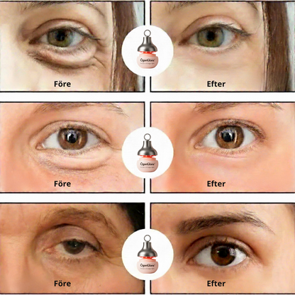 ÖgonGlans™ | Infraröd ögonvård för svullna ögon och mörka ringar