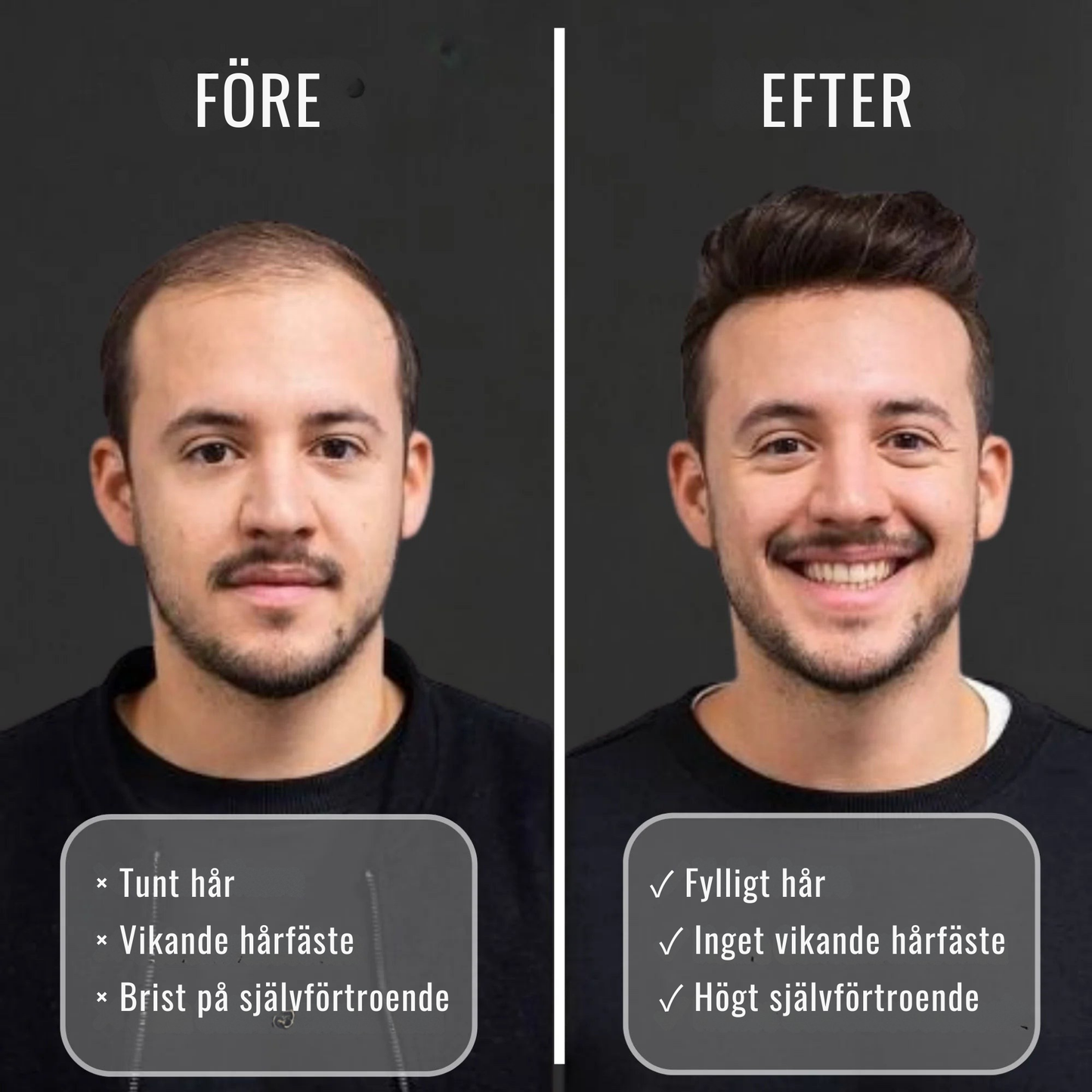 HårVital™ | Närande hårolja Som hjälper till att stimulera ny hårväxt och stärka hårsäckarna.