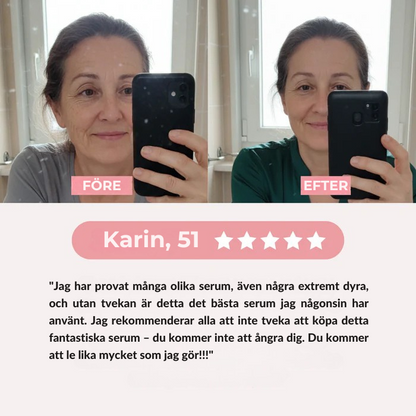 Elyna - PDRN Rosa Kollagen Exosom Shot Serum