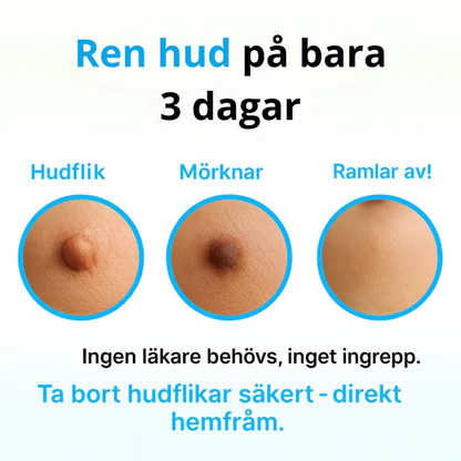 NORDIKE™ - Premiumset mot hudflikar – Synliga resultat utan smärta