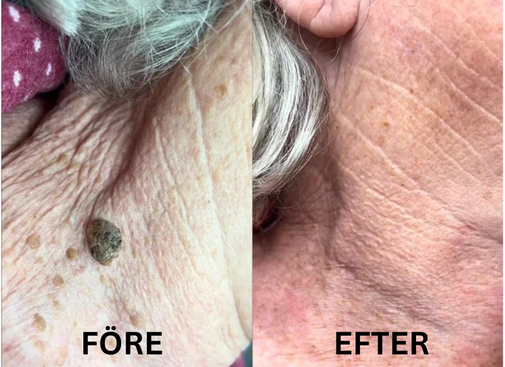 KlarHyll | Hudreparerande essence-kräm