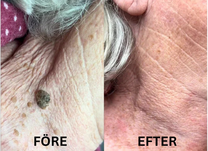 KlarHyll | Hudreparerande essence-kräm