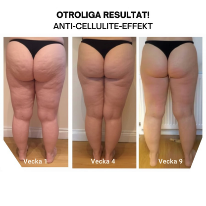 FormLyx™ | Kompression för mer kraft och uppstramning